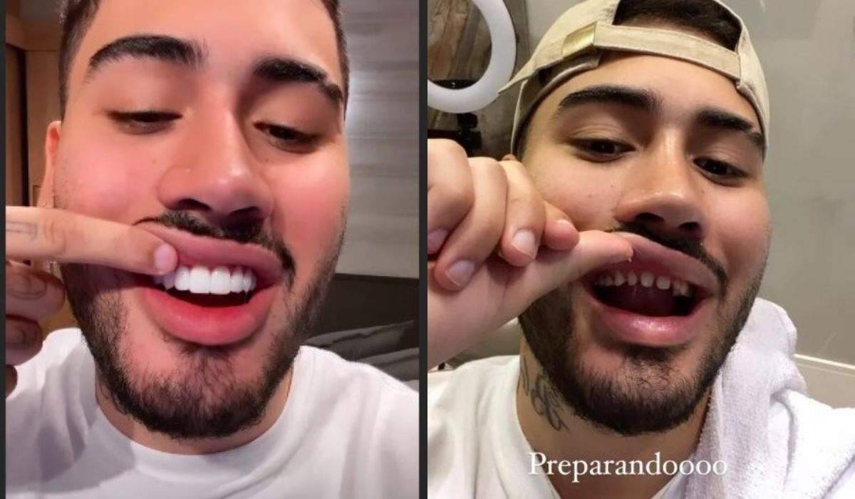 O cantor Kevinho aparece sem as lentes de contato dental e vira meme nas redes sociais