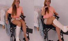 Nicole Bahls conta sobre rotina após quebrar o pé: "são poucos dias, mas estou sofrendo"