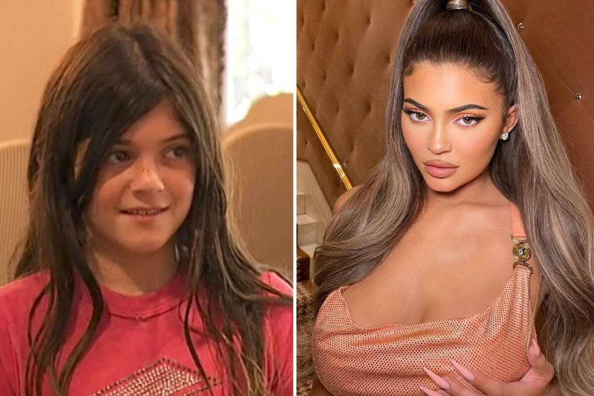 Após trailer, fãs se chocam com diferença do rosto de Kylie Jenner ao longo dos anos