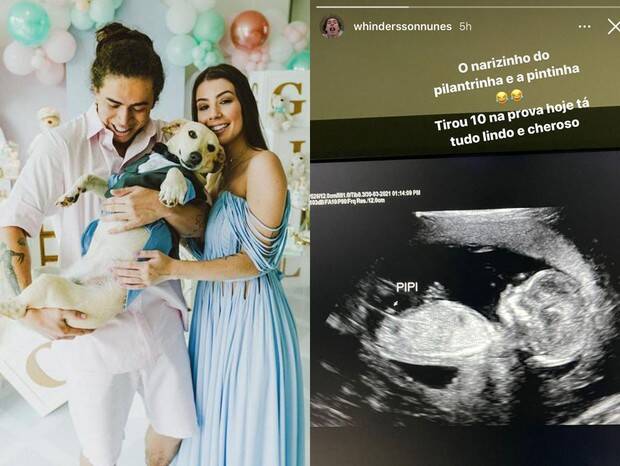 Whindersson Nunes exibe animado novo ultrassom do filho: 'tá tudo lindo' (Foto: Reprodução/Instagram)