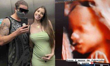 Namorada de Whindersson exibe novo ultrassom com rostinho do bebê