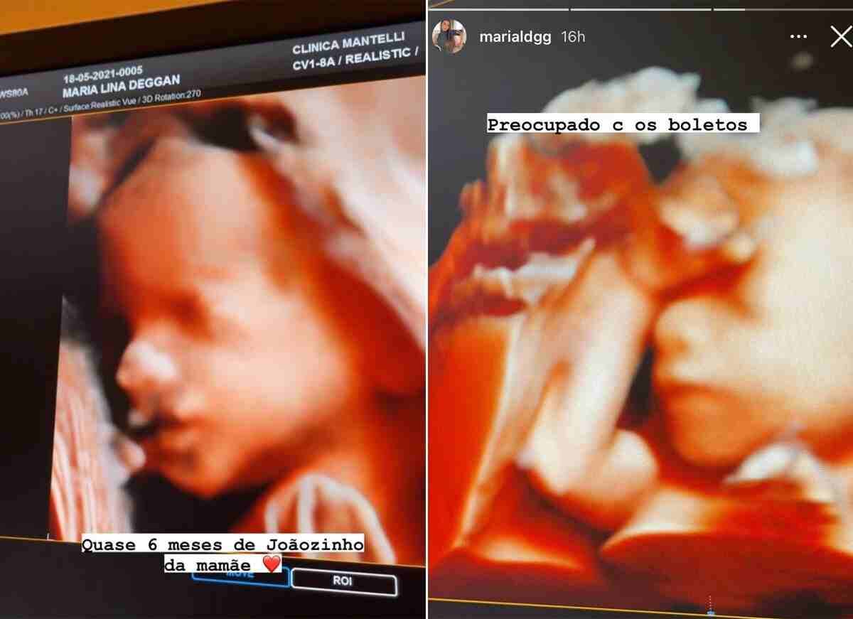 Namorada de Whindersson exibe novo ultrassom com rostinho do bebê (Foto: Reprodução/Instagram)