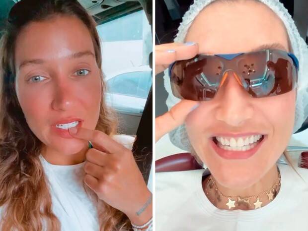 Gabriela Pugliesi muda lentes de contato dos dentes: 'mais imperfeito' (Foto: Reprodução/Instagram)