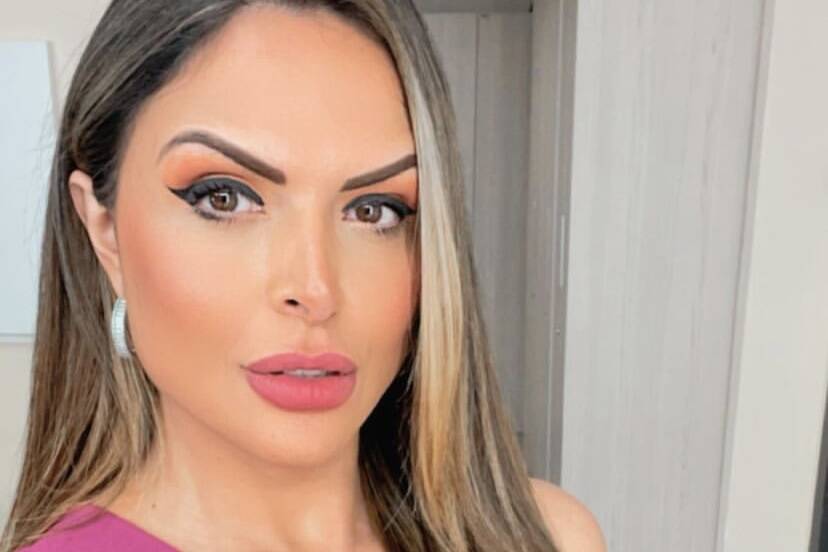 Silvye Alves passa por cirurgia no rosto após agressão do ex-namorado