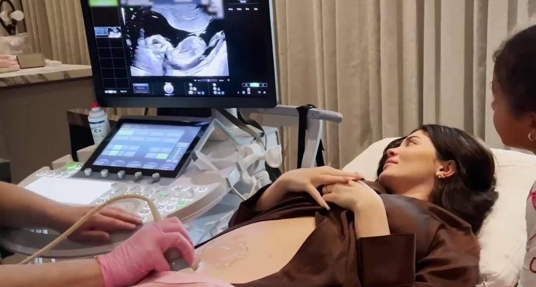 Kylie Jenner anuncia gravidez de seu segundo filho com Travis Scott (Foto: Reprodução/Instagram)